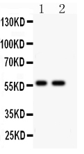 pa2215 1 WB anti pias4 piasy antibody