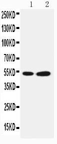 Anti-SBP/SELENBP1 antibody, PA2216, Western blottingLane 1: COLO320 Cell LysateLane 2: PANC Cell Lysate