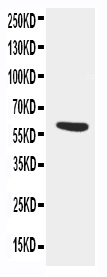 pa2217 1 WB anti alpha 1 antichymotrypsin antibody