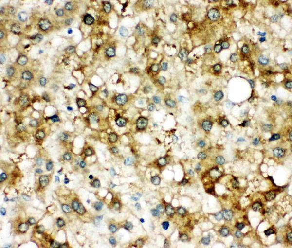 pa2217 2 IHC anti alpha 1 antichymotrypsin antibody