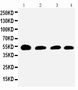 Anti-Antithrombin III antibody, PA2218, Western blottingLane 1: Rat Testis Tissue LysateLane 2: SMMC Cell LysateLane 3: JURKAT Cell LysateLane 4: RAJI Cell Lysate