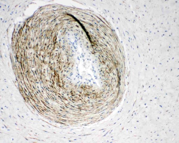 pa2224 1 IHC anti calponin antibody