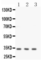 pa2224 2 WB anti calponin antibody
