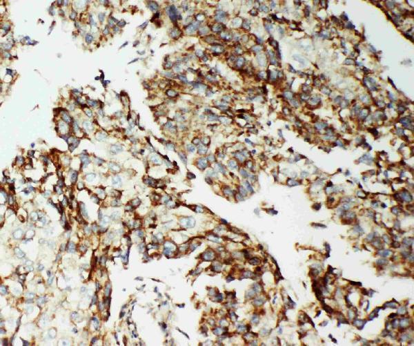 pa2232 1 IHC anti aif antibody