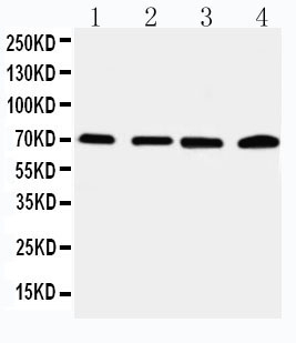 pa2236 1 WB anti irak2 antibody
