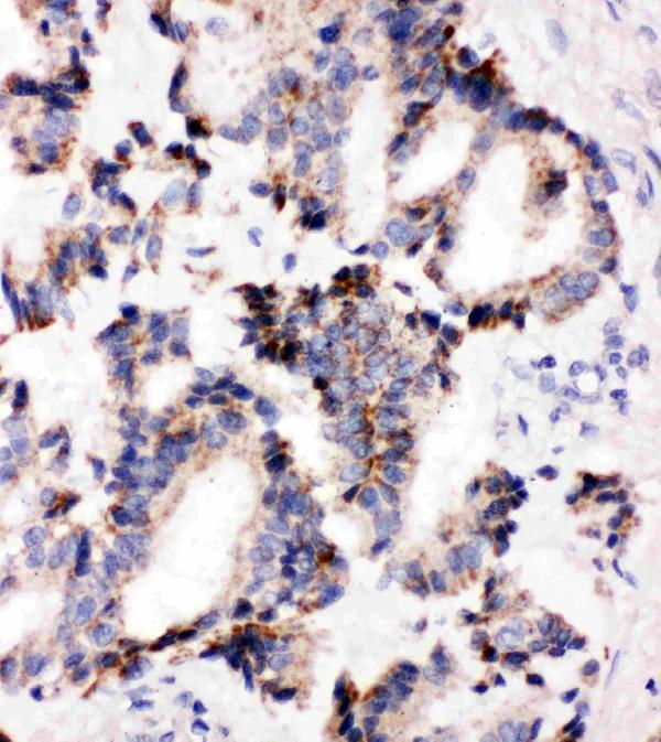 pa2236 2 IHC anti irak2 antibody