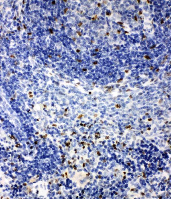 pa2236 3 IHC anti irak2 antibody