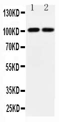 pa2249 1 WB anti gria3 glur 3 antibody