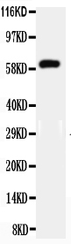 pa2267 2 WB anti hnf1 beta antibody