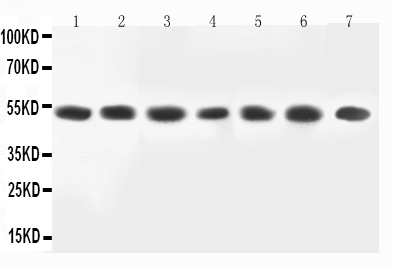 pa2274 1 WB anti mek2 antibody