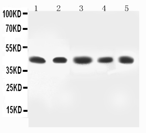 Anti-MEK4 antibody, PA2275, All Western blotting All lanes: Anti-MAP2K4(PA2275) at 0.5ug/ml