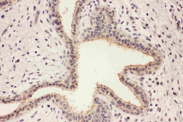 pa2280 2 IHC anti rab8a antibody