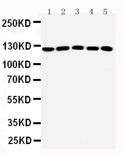 Anti-ST5 antibody, PA2287, All Western blotting All lanes: Anti-ST5(PA2287) at0.5ug/ml Lane 1: Rat Testis Tissue Lysate at 40ug Lane 2: A431 Whole Cell Lysate at 40ug Lane 3: HELA Whole Cell Lysate at 40ug Lane 4: COLO320 Whole Cell Lysate at 40ug Lane 5: NIH/3T3 Whole Cell Lysate at 40ug Predicted bind size: 126KD Observed bind size: 126KD