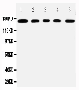 pa2302 1 WB anti muc1 antibody