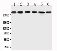 pa2303 1 WB anti mucin 5ac antibody