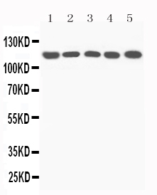 pa2308 4 WB anti complement c5a antibody