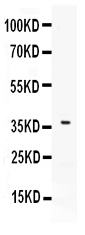 Western blot analysis of B7 DC using anti-B7 DC antibody (PB10010).