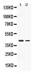 Figure 1. Western blot analysis of Abhd5 using anti-Abhd5 antibody (PB10021). Electrophoresis was performed on a 5-20% SDS-PAGE gel at 70V (Stacking gel) / 90V (Resolving gel) for 2-3 hours. The sample well of each lane was loaded with 50ug of sample under reducing conditions. Lane 1: rat kidney tissue lysates, Lane 2: A431 whole cell lysates, After Electrophoresis, proteins were transferred to a Nitrocellulose membrane at 150mA for 50-90 minutes. Blocked the membrane with 5% Non-fat Milk/ TBS for 1.5 hour at RT. The membrane was incubated with rabbit anti-Abhd5 antigen affinity purified polyclonal antibody (Catalog # PB10021) at 0.5 microg/mL overnight at 4°C, then washed with TBS-0.1%Tween 3 times with 5 minutes each and probed with a goat anti-rabbit IgG-HRP secondary antibody at a dilution of 1:10000 for 1.5 hour at RT. The signal is developed using an Enhanced Chemiluminescent detection (ECL) kit (Catalog # EK1002) with Tanon 5200 system. A specific band was detected for Abhd5 at approximately 43KD. The expected band size for Abhd5 is at 39KD.