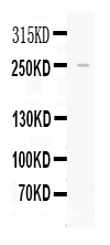 Figure 1. Western blot analysis of Apolipoprotein CIII using anti-Apolipoprotein CIII antibody (PB10042). Electrophoresis was performed on a 5-20% SDS-PAGE gel at 70V (Stacking gel) / 90V (Resolving gel) for 2-3 hours. The sample well of each lane was loaded with 30 ug of sample under reducing conditions. Lane 1: HELA whole cell lysates. After electrophoresis, proteins were transferred to a nitrocellulose membrane at 150 mA for 50-90 minutes. Blocked the membrane with 5% non-fat milk/TBS for 1.5 hour at RT. The membrane was incubated with rabbit anti-Apolipoprotein CIII antigen affinity purified polyclonal antibody (Catalog # PB10042) at 0.5 microg/mL overnight at 4°C, then washed with TBS-0.1%Tween 3 times with 5 minutes each and probed with a goat anti-rabbit IgG-HRP secondary antibody at a dilution of 1:5000 for 1.5 hour at RT. The signal is developed using an Enhanced Chemiluminescent detection (ECL) kit (Catalog # EK1002) with Tanon 5200 system. A specific band was detected for Apolipoprotein CIII at approximately 250 kDa. The expected band size for Apolipoprotein CIII is at 516 kDa.