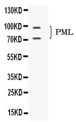  Western blot analysis of PML Protein using anti-PML Protein antibody (PB10085)