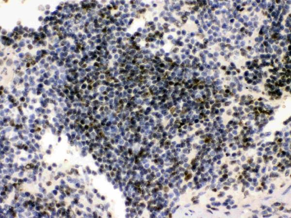  IHC analysis of PML Protein using anti-PML Protein antibody (PB10085)