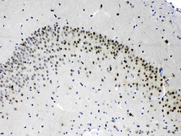Figure 3. IHC analysis of PSMA3 using anti-PSMA3 antibody (PB10089). PSMA3 was detected in paraffin-embedded section of rat brain tissues. Heat mediated antigen retrieval was performed in citrate buffer (pH6, epitope retrieval solution) for 20 mins. The tissue section was blocked with 10% goat serum. The tissue section was then incubated with 1microg/ml rabbit anti-PSMA3 Antibody (PB10089) overnight at 4°C. Biotinylated goat anti-rabbit IgG was used as secondary antibody and incubated for 30 minutes at 37°C. The tissue section was developed using Strepavidin-Biotin-Complex (SABC)(Catalog # SA1022) with DAB as the chromogen.