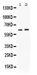 Western blot analysis of SCTR using anti-SCTR antibody (PB10096).