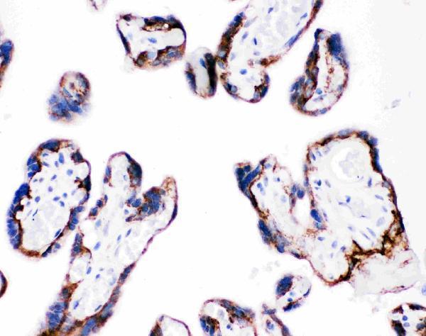 pb9007 2 IHC anti integrin beta 4 picoband antibody