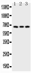 Anti-CD30 Picoband antibody, RP1029.jpg All lanes: Anti-CD30(RP1029) at 0.5ug/ml Lane 1: HELA Whole Cell Lysate at 40ug Lane 2: 293T Whole Cell Lysate at 40ug Lane 3: JURKAT Whole Cell Lysate at 40ug Predicted bind size: 67KD Observed bind size: 67KD