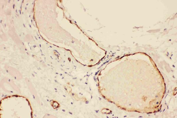 pb9062 1 IHC anti vwf von willebrand factor picoband antibody