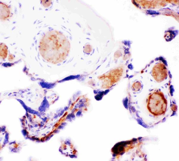  IHC analysis of Wnt5a using anti-Wnt5a antibody (PB9063)