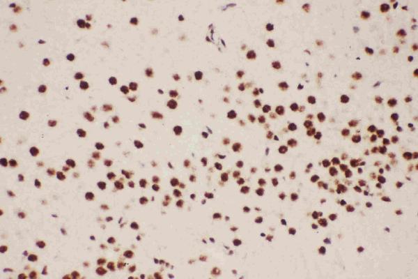 Anti-ALOX5 Picoband antibody, RP1031-2.JPG IHC(P): Rat Brain Tissue Anti-ALOX5 Picoband antibody, RP1031-2.JPG IHC(P): Rat Brain Tissue