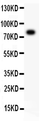 Anti-ALOX5 Picoband antibody, RP1031-5.jpg All lanes: Anti-ALOX5 (RP1031) at 0.5ug/ml WB: SGC Whole Cell Lysate at 40ug Predicted bind size: 78KD Observed bind size: 78KD Anti-ALOX5 Picoband antibody, RP1031-5.jpg All lanes: Anti-ALOX5 (RP1031) at 0.5ug/ml WB: SGC Whole Cell Lysate at 40ug Predicted bind size: 78KD Observed bind size: 78KD