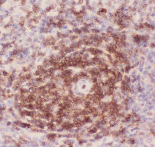 Figure 3. IHC analysis of CD43 using anti-CD43 antibody (PB9095). CD43 was detected in paraffin-embedded section of rat spleen tissues. Heat mediated antigen retrieval was performed in citrate buffer (pH6, epitope retrieval solution) for 20 mins. The tissue section was blocked with 10% goat serum. The tissue section was then incubated with 1microg/ml rabbit anti-CD43 Antibody (PB9095) overnight at 4°C. Biotinylated goat anti-rabbit IgG was used as secondary antibody and incubated for 30 minutes at 37°C. The tissue section was developed using Strepavidin-Biotin-Complex (SABC)(Catalog # SA1022) with DAB as the chromogen.