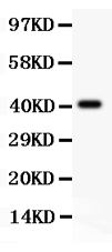 pb9117 1 RP1035 WB anti scp3 antibody