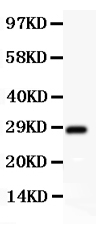 pb9117 2 RP1035 WB anti scp3 antibody