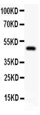 Figure 2. Western blot analysis of AP2 alpha using anti-AP2 alpha antibody (PB9118). Electrophoresis was performed on a 5-20% SDS-PAGE gel at 70V (Stacking gel) / 90V (Resolving gel) for 2-3 hours. The sample well of each lane was loaded with 30 ug of sample under reducing conditions. Lane 1: rat spleen tissue lysates. After electrophoresis, proteins were transferred to a nitrocellulose membrane at 150 mA for 50-90 minutes. Blocked the membrane with 5% non-fat milk/TBS for 1.5 hour at RT. The membrane was incubated with rabbit anti-AP2 alpha antigen affinity purified polyclonal antibody (Catalog # PB9118) at 0.5 microg/mL overnight at 4°C, then washed with TBS-0.1%Tween 3 times with 5 minutes each and probed with a goat anti-rabbit IgG-HRP secondary antibody at a dilution of 1:5000 for 1.5 hour at RT. The signal is developed using an Enhanced Chemiluminescent detection (ECL) kit (Catalog # EK1002) with Tanon 5200 system. A specific band was detected for AP2 alpha at approximately 48 kDa. The expected band size for AP2 alpha is at 48 kDa.