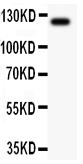 Anti-TIE2 Picoband antibody, RP1036-2