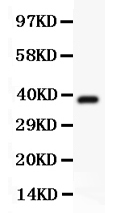pb9120 1 WB anti hamartin picoband antibody