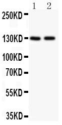 pb9120 2 WB anti hamartin picoband antibody