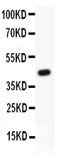 Figure 1. Western blot analysis of HIF1 using anti-HIF1 antibody (PB9129). Electrophoresis was performed on a 5-20% SDS-PAGE gel at 70V (Stacking gel) / 90V (Resolving gel) for 2-3 hours. Lane 1: recombinant human HIF1 beta protein 0.5 ng. After electrophoresis, proteins were transferred to a nitrocellulose membrane at 150 mA for 50-90 minutes. Blocked the membrane with 5% non-fat milk/TBS for 1.5 hour at RT. The membrane was incubated with rabbit anti-HIF1 antigen affinity purified polyclonal antibody (Catalog # PB9129) at 0.5 microg/mL overnight at 4°C, then washed with TBS-0.1%Tween 3 times with 5 minutes each and probed with a goat anti-rabbit IgG-HRP secondary antibody at a dilution of 1:5000 for 1.5 hour at RT. The signal is developed using an Enhanced Chemiluminescent detection (ECL) kit (Catalog # EK1002) with Tanon 5200 system. A specific band was detected for HIF1 at approximately 49 kDa. The expected band size for HIF1 is at 49 kDa.