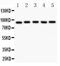 Figure 2. Western blot analysis of HIF1 using anti-HIF1 antibody (PB9129). Electrophoresis was performed on a 5-20% SDS-PAGE gel at 70V (Stacking gel) / 90V (Resolving gel) for 2-3 hours. The sample well of each lane was loaded with 30 ug of sample under reducing conditions. Lane 1: human Hela whole cell lysates, Lane 2: human 293T whole cell lysates, Lane 3: human Jurkat whole cell lysates, Lane 4: human U87 whole cell lysates, Lane 5: human COLO320 whole cell lysates. After electrophoresis, proteins were transferred to a nitrocellulose membrane at 150 mA for 50-90 minutes. Blocked the membrane with 5% non-fat milk/TBS for 1.5 hour at RT. The membrane was incubated with rabbit anti-HIF1 antigen affinity purified polyclonal antibody (Catalog # PB9129) at 0.5 microg/mL overnight at 4°C, then washed with TBS-0.1%Tween 3 times with 5 minutes each and probed with a goat anti-rabbit IgG-HRP secondary antibody at a dilution of 1:5000 for 1.5 hour at RT. The signal is developed using an Enhanced Chemiluminescent detection (ECL) kit (Catalog # EK1002) with Tanon 5200 system. A specific band was detected for HIF1 at approximately 87 kDa. The expected band size for HIF1 is at 87 kDa. Figure 2. Western blot analysis of HIF1 using anti-HIF1 antibody (PB9129). Electrophoresis was performed on a 5-20% SDS-PAGE gel at 70V (Stacking gel) / 90V (Resolving gel) for 2-3 hours. The sample well of each lane was loaded with 30 ug of sample under reducing conditions. Lane 1: human Hela whole cell lysates, Lane 2: human 293T whole cell lysates, Lane 3: human Jurkat whole cell lysates, Lane 4: human U87 whole cell lysates, Lane 5: human COLO320 whole cell lysates. After electrophoresis, proteins were transferred to a nitrocellulose membrane at 150 mA for 50-90 minutes. Blocked the membrane with 5% non-fat milk/TBS for 1.5 hour at RT. The membrane was incubated with rabbit anti-HIF1 antigen affinity purified polyclonal antibody (Catalog # PB9129) at 0.5 microg/mL overnight at 4°C, then washed with TBS-0.1%Tween 3 times with 5 minutes each and probed with a goat anti-rabbit IgG-HRP secondary antibody at a dilution of 1:5000 for 1.5 hour at RT. The signal is developed using an Enhanced Chemiluminescent detection (ECL) kit (Catalog # EK1002) with Tanon 5200 system. A specific band was detected for HIF1 at approximately 87 kDa. The expected band size for HIF1 is at 87 kDa.