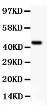 pb9140 1 WB anti cd11b picoband antibody