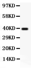 Western blot validation image for SIRT3 using PB9161; observed band 43.6 kDa