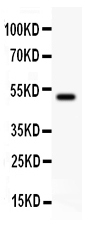 pb9178 1 WB anti kat3b p300 picoband antibody