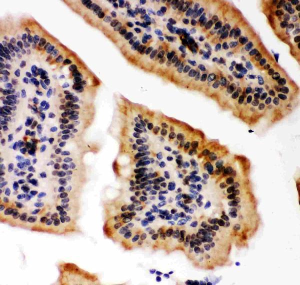 pb9178 3 IHC anti kat3b p300 picoband antibody