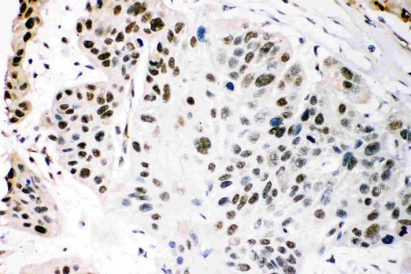 pb9178 5_1 IHC anti kat3b p300 picoband antibody