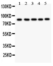 pb9194 1 WB anti foxm1 picoband antibody