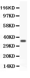 pb9194 2 WB anti foxm1 picoband antibody