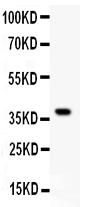 Figure 1. Western blot analysis of GRIA1 using anti-GRIA1 antibody (PB9204). Electrophoresis was performed on a 5-20% SDS-PAGE gel at 70V (Stacking gel) / 90V (Resolving gel) for 2-3 hours. lane 1: Recombinant Human GRIA1 Protein 0.5ng. After Electrophoresis, proteins were transferred to a Nitrocellulose membrane at 150mA for 50-90 minutes. Blocked the membrane with 5% Non-fat Milk/ TBS for 1.5 hour at RT. The membrane was incubated with rabbit anti-GRIA1 antigen affinity purified polyclonal antibody (Catalog # PB9204) at 0.5 microg/mL overnight at 4°C, then washed with TBS-0.1%Tween 3 times with 5 minutes each and probed with a goat anti-rabbit IgG-HRP secondary antibody at a dilution of 1:10000 for 1.5 hour at RT. The signal is developed using an Enhanced Chemiluminescent detection (ECL) kit (Catalog # EK1002) with Tanon 5200 system. A specific band was detected for GRIA1 at approximately 40KD. The expected band size for GRIA1 is at 40KD.